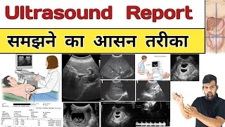 Ultrasound Report  Sonography  USG  Gynacology  Doctor  Nursing  Hospital  Treatment  Bhms [upl. by Collin]