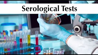 Microbiology 5th practical tuotorial quotSerological Testsquot by ASM Minds Team [upl. by Miche]