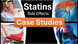 Statin Side Effects Case Studies [upl. by Nena342]