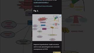 The Glitch in the HypothalamusPituitaryOvarian Axis Causing Polycystic Ovarian Syndrome [upl. by Attah]