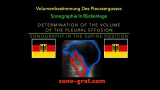 Sonographie  Bestimmung des Volumens des Pleuraergusses in Rückenlage [upl. by Rowley]