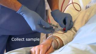 Collecting an arterial line sample [upl. by Aneema830]