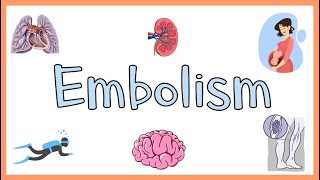 Embolism  Definition Types of Embolism amp Clinical Manifestations [upl. by Eeznyl]