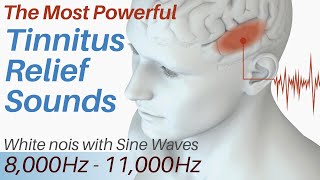 Tinnitus Relief Sounds  White Noise amp Sine Waves 8000Hz  11000Hz  Tinnitus Sound Therapy [upl. by Neiluj]