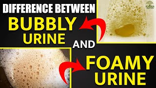 shorts Difference Between Bubbly Urine and Foamy Urine  Karma Ayurveda Reviews  Kidney Expert USA [upl. by Aetnuahs]