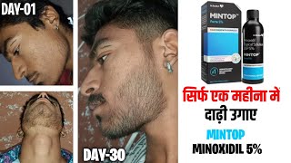 1 month results of mintop minoxidil  minoxidil beard growth  minoxidil beard  mintop minoxidil [upl. by Macfarlane137]