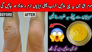 Get Rid Of Cracked Heels Naturally At Home  Get smoothsoft heels permanently in just 7 days  Tips [upl. by Yatnod]