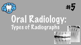 Oral Radiology  Types of Radiographs  INBDE ADAT [upl. by Grider]