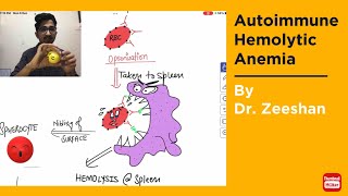 Autoimmune Hemolytic Anemia in Hindi  Hinglish ft Robbin’s pathology neetpg2022 inicet [upl. by Sarge27]