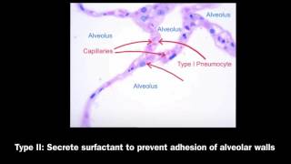 pneumocytes or alveolar epithelial cells notes [upl. by Femmine]