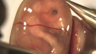 Isolation and injection of an E155 mouse embryo [upl. by Ailerua]