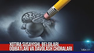 Xotira susayishi belgilari oqibatlari va davolash choralari [upl. by Roberts]