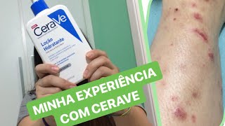 A VERDADE sobre o creme CERAVE [upl. by Enyawad614]