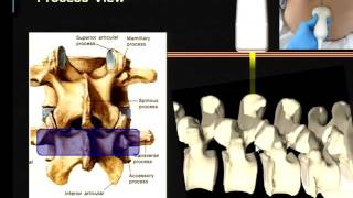 Regional Anesthesia  Ultrasound Assisted  Guided Neuraxial Block [upl. by Ariam]