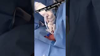 How to place central Venous catheterCVC cvc medicalpedicure ivline intravenousinjection docto [upl. by Trenna]