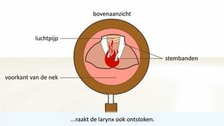 Keelontsteking  de oorzaak en behandeling [upl. by Yar]