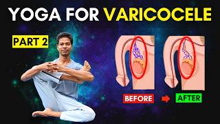 Varicocele Exercises Part 2 Follow Along At Home  Yoga for Varicocele varicocele [upl. by Forta756]