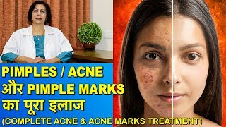 eczema  atopic dermatitis  in hindi  cause symptoms treatment nursing management skin disease [upl. by Trudie]