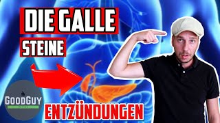 Die GalleGallensteineSchmerzen und deren Ursache [upl. by Thagard]