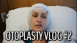 Otoplasty Ear Pinning Vlog Part 2  Surgery  Pain  Recovery amp Results [upl. by Halilak660]