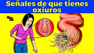 Señales de alarma de que tienes oxiuros parásitos intestinales [upl. by Poyssick]