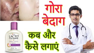 Lacto Calamine face lotion HONEST Review 2023 in hindi  Results Benefits Uses Price Info [upl. by Yntrok819]