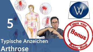 ArthroseLüge 5 Anzeichen für Arthrose im Gelenk  diese Symptome amp Tipps sollten Sie kennen ⚠️ [upl. by Valorie]