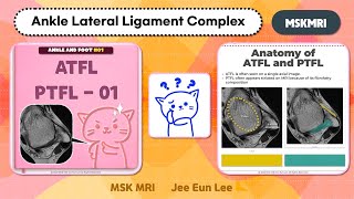 Ankle and Foot01 anterior talofibular ligament ATFL and posterior talofibular ligament PTFL [upl. by Oniliuqnart860]