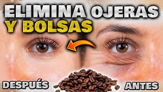 ELIMINA OJERAS BOLSAS y ARRUGAS en MINUTOS ANTIOJERAS EFECTIVO y NATURAL  Cómo quitar las Ojeras [upl. by Eilhsa119]