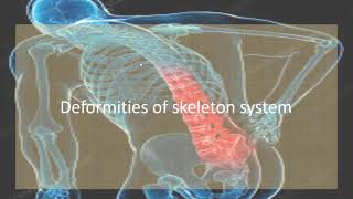 Joints and Deformities of Skeleton Lecture  18 [upl. by Ttekcirc]