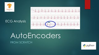 Anomaly Detection with AutoEncoders using Tensorflow [upl. by Jumbala635]