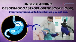 Understanding OGD Your Complete Guide to Upper Digestive Tract Examination endoscopy stomach [upl. by Cheng]