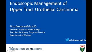 Endoscopic Management of UTUC  EMPIRE Urology Lecture Series [upl. by Aneelad]