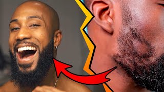 COMMENT DENSIFIER LA BARBE ET COMBLER LES TROUS DANS SA BARBE toppik VS teinture à barbe [upl. by Nodal]