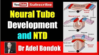 Neural Tube Development and Neural Tube Defects NTD Dr Adel Bondok [upl. by Eillak717]