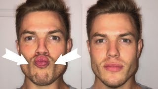 3 Exercises To Lose CHUBBY Cheeks Get a Defined Face [upl. by Unity]