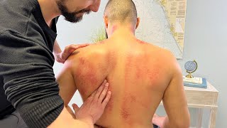 Grown Man Tries Not To Cry During Massage 😢 Huge Back amp Shoulder Knots Clunky Joints Get CRUNCHED [upl. by Marnia]