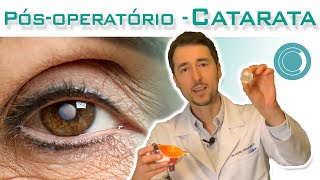 Pósoperatório da cirurgia de catarata [upl. by Backer112]