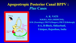 Apogeotropic Posterior Canal BPPV  Newer Insights [upl. by Barsky929]