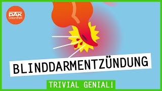 Blinddarmentzündung Wie sie entsteht und du sie erkennst  Trivial Genial  DAKGesundheit [upl. by Ened]