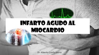 reperfusión en el infarto agudo al miocardio activación evaluación [upl. by Arie]