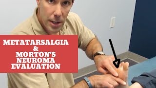 Metatarsalgia and Mortons Neuroma Evaluation and Treatment [upl. by Esyahc951]