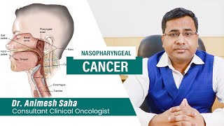 Nasopharyngeal cancer awareness  Best Oncologist in Kolkata  Cancer Specialist in Kolkata [upl. by Odnesor]