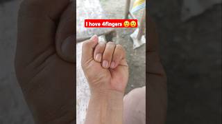 I hove 4fingers 😲😲 challenge hand finger [upl. by Goltz]