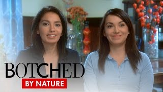 Botched by Nature  Twins Need Help on quotBotched By Naturequot  E [upl. by Eimat]