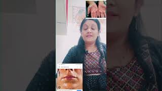 dr motivation Hyperhydrosis Homoeopathic medicine drpoonam Drpunam Sharmapathak [upl. by Skees164]