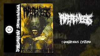 Hyperemesis  Archagathus FULL split 2015 Goregrind [upl. by Lapo]