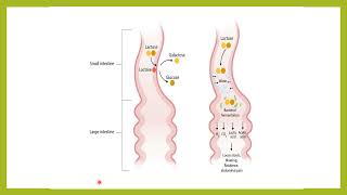 Acute gastroenteritis Dr Alaa AlDalaien Lecture Mutah University [upl. by Gemoets]