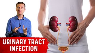 Top Remedies for a UTI Urinary Tract Infection Updated [upl. by Zillah749]