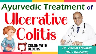 Ayurvedic Treatment of Ulcerative Colitis  Dr Vikram Chauhan [upl. by Dusa]